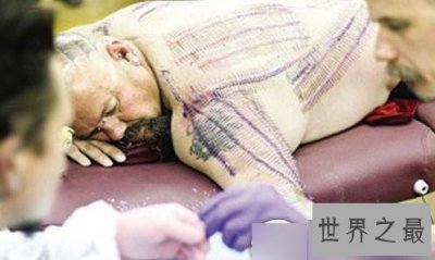 ​一次性在身上插最多钢针的人，总共1501枚(吓死人)